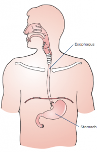 expert-top-esophagectomy-cancer-surgeon-nyc-01
