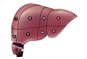 liver resection