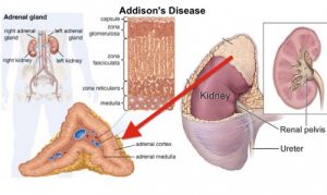 Adrenal glands