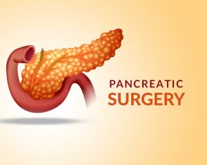 pancreatic-surgery-expert-surgeon-medical-information-01