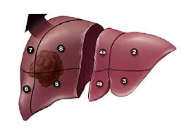 resection-surgeon-for-liver-cancer-02