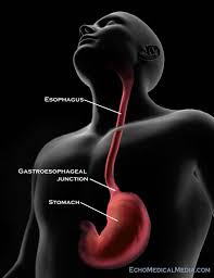 esophagus-surgery-info-surgeons-new-york-01