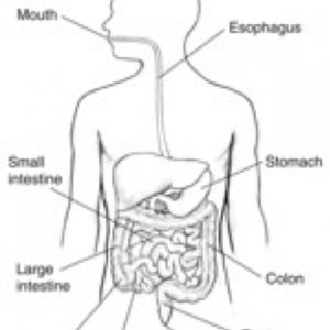 Esophagus Surgery for Cancer & Esophagectomy