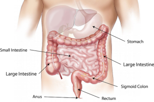 Resection of Colon - Top Surgeons NYC