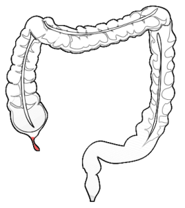 procedures for colon conditions