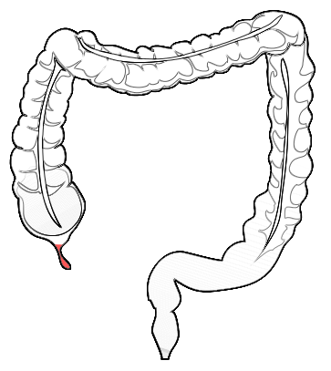 procedures for colon conditions